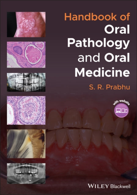 HANDBOOK OF ORAL PATHOLOGY AND ORAL MEDICINE