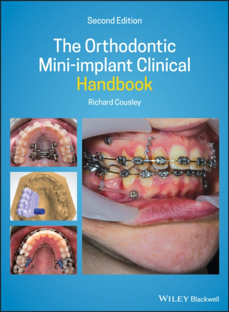 ORTHODONTIC MINI-IMPLANT CLINICAL HANDBOOK, 2ND ED