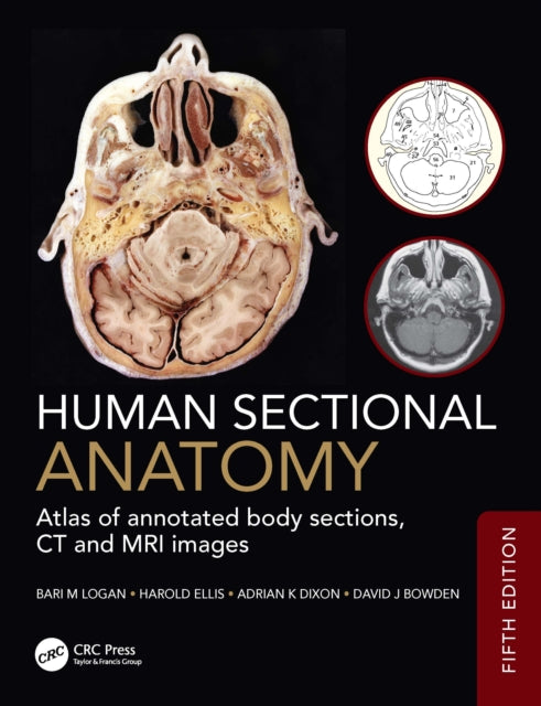Human Sectional Anatomy