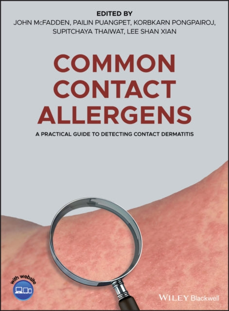 COMMON CONTACT ALLERGENS: A PRACTICAL GUIDE