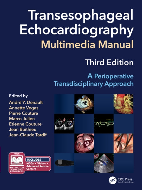 Transesophageal Echocardiography Multimedia Manual