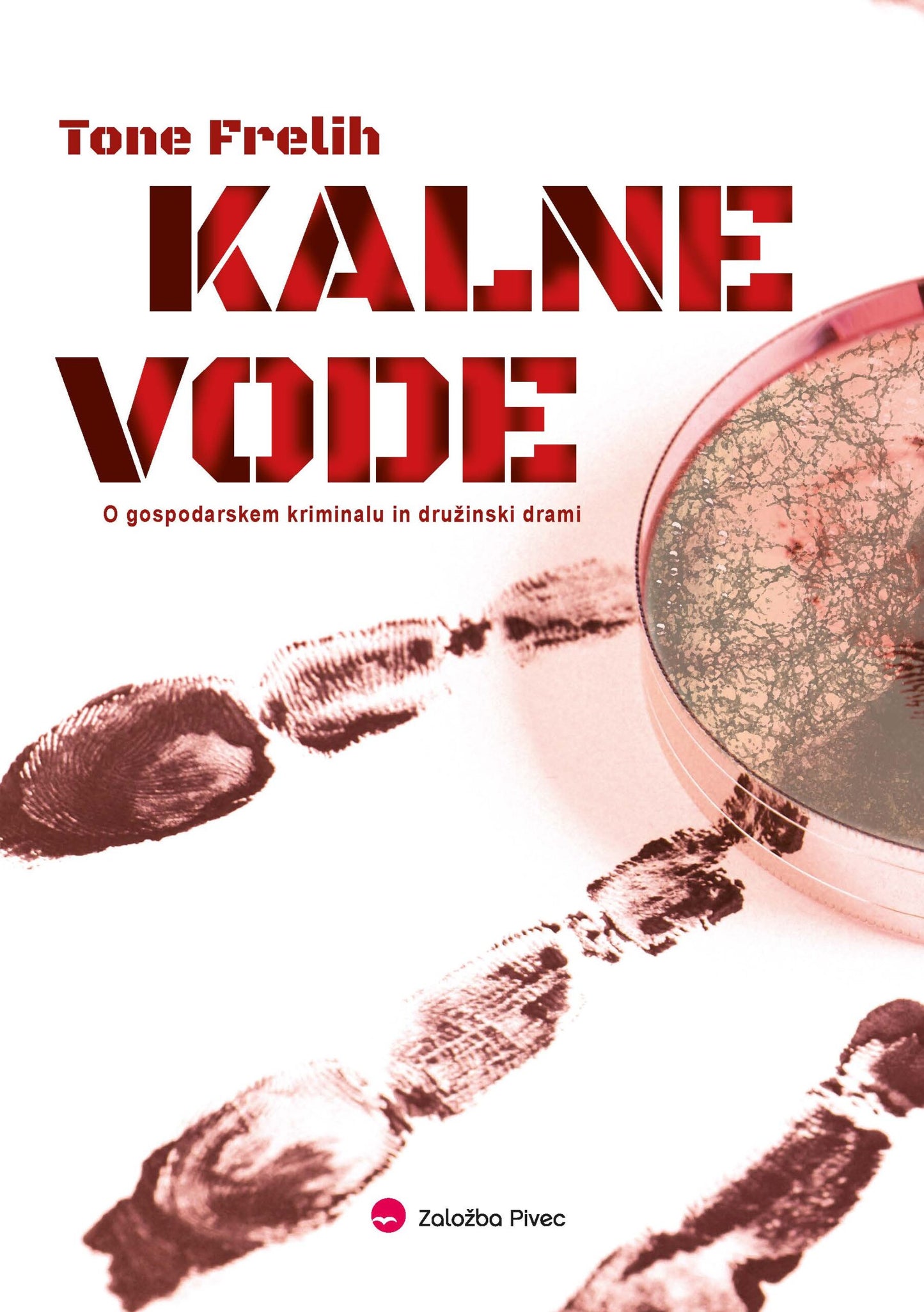 KALNE VODE