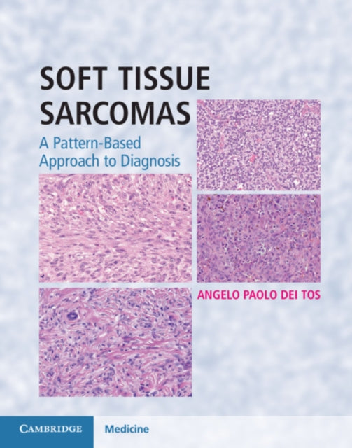 SOFT TISSUE SARCOMAS TRD WITH ONLINE RESOURCE