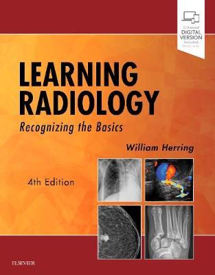 Learning Radiology - Recognizing the Basics