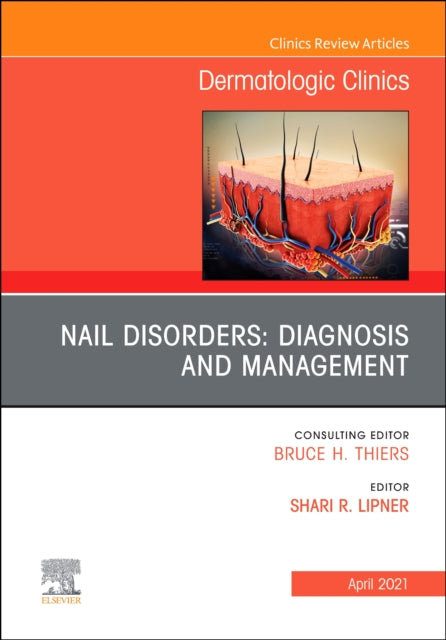 Nail Disorders: Diagnosis and Management, An Issue of Dermatologic Clinics