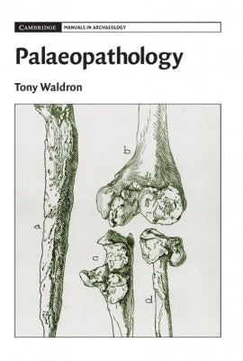 Palaeopathology