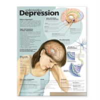 Understanding Depression Anatomical Chart