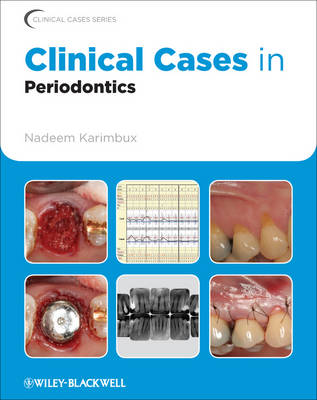 CLINICAL CASES IN PERIODONTICS