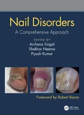 Nail Disorders - A Comprehensive Approach