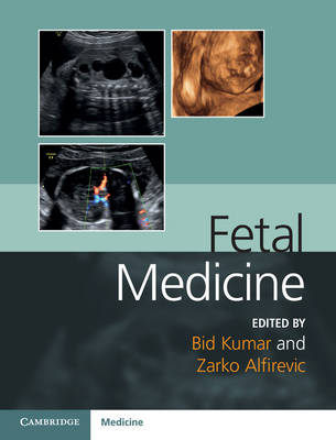 FETAL MEDICINE