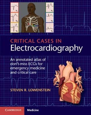 Critical Cases in Electrocardiography - An Annotated Atlas of Don't-Miss ECGs for Emergency Medicine and Critical Care