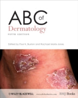 ABC of Dermatology