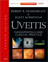 UVEITIS