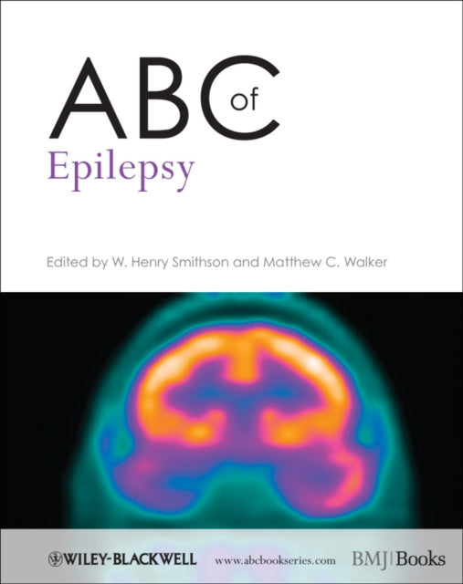 ABC OF EPILEPSY
