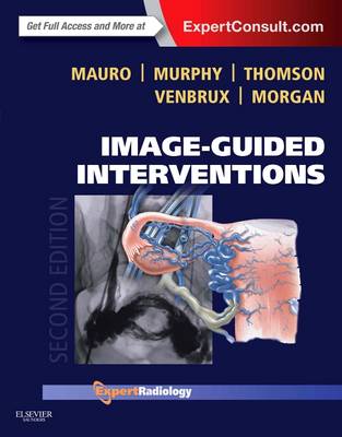Image-Guided Interventions: Expert Radiology Series