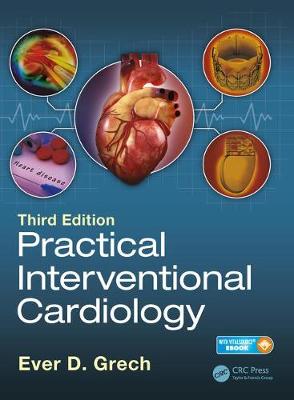 PRACTICAL INTERVENTIONAL CARDIOLOGY