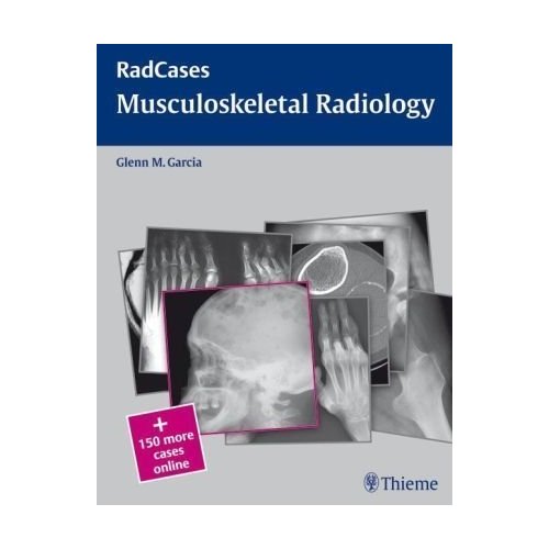 MUSCULOSKELETAL RADIOLOGY