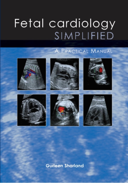 Fetal Cardiology Simplified