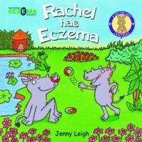 RACHEL HAS ECZEMA
