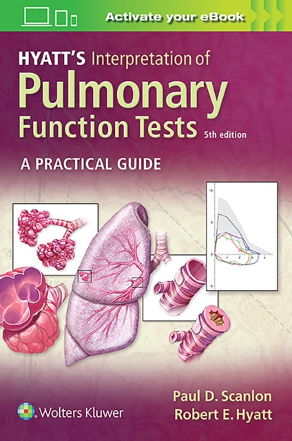HYATT`S INTERPRETATION OF PULMONARY FUNCTION TESTS