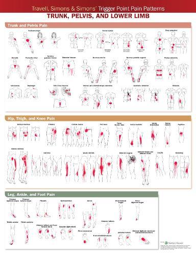 Travell, Simons & Simons’ Trigger Point Pain Patterns Wall Chart