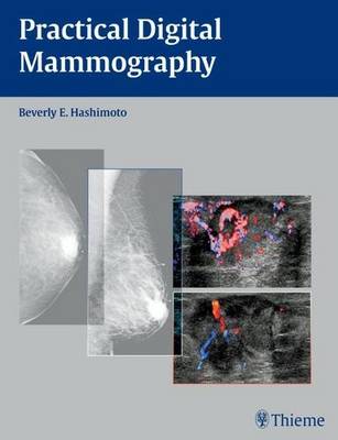 PRACTICAL DIGITAL MAMMOGRAPHY