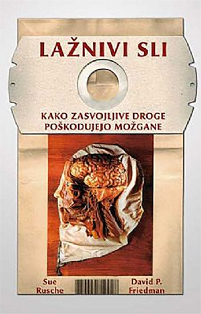 Lažnivi sli: kako zasvojljive droge poškodujejo možgane