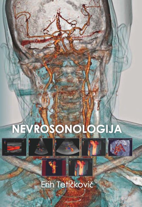 NEVROSONOLOGIJA