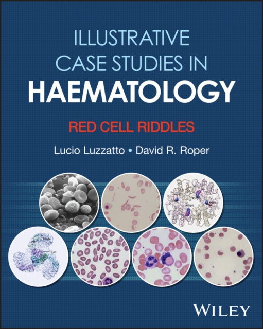 Illustrative Case Studies in Haematology: Red Cell  Riddles