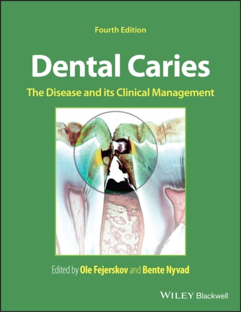 Dental Caries