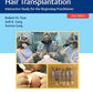 Practical Guide to Hair Transplantation: Interactive Study for the Beginning Practitioner