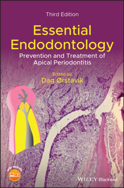 ESSENTIAL ENDODONTOLOGY: PREVENTION AND TREATMENT