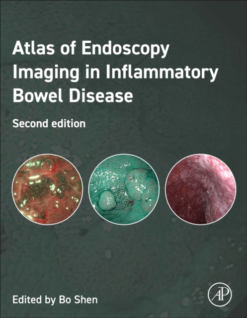 Atlas of Endoscopy Imaging in Inflammatory Bowel Disease