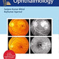 Textbook of Ophthalmology