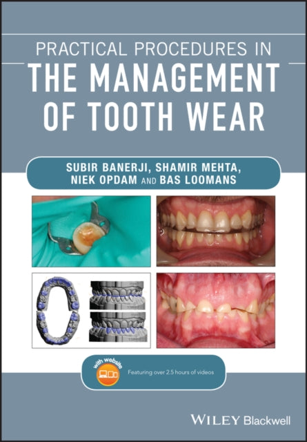 PRACTICAL PROCEDURES IN THE MANAGEMENT OF TOOTH WE