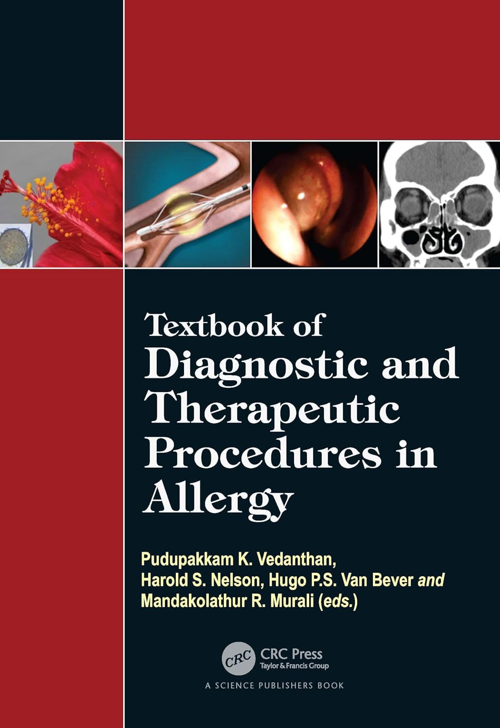 Textbook of Diagnostic and Therapeutic Procedures in Allergy