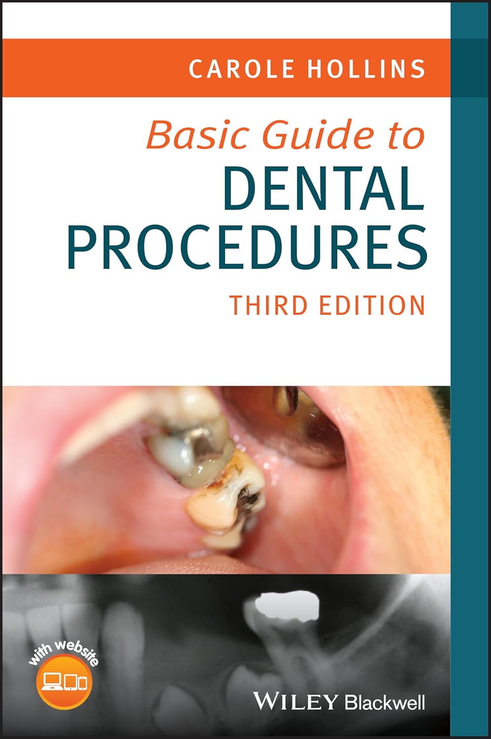 Basic Guide to Dental Procedures