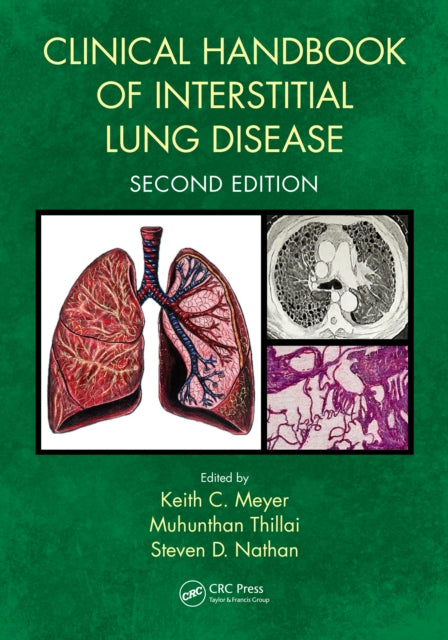 Clinical Handbook of Interstitial Lung Disease