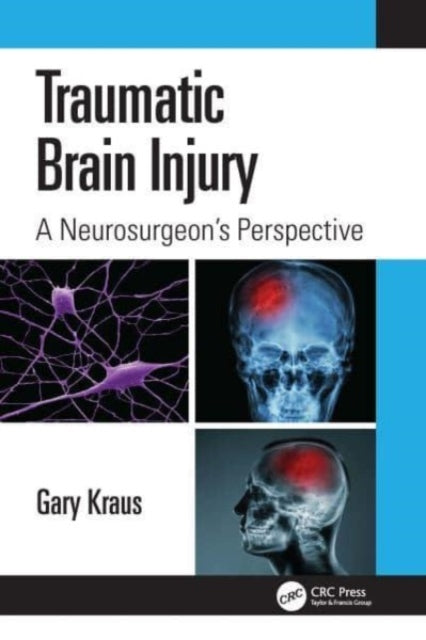 Traumatic Brain Injury: A Neurosurgeon's Perspective