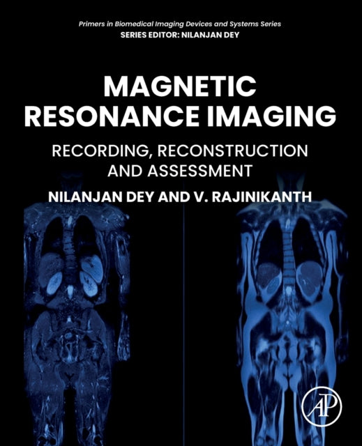 Magnetic Resonance Imaging