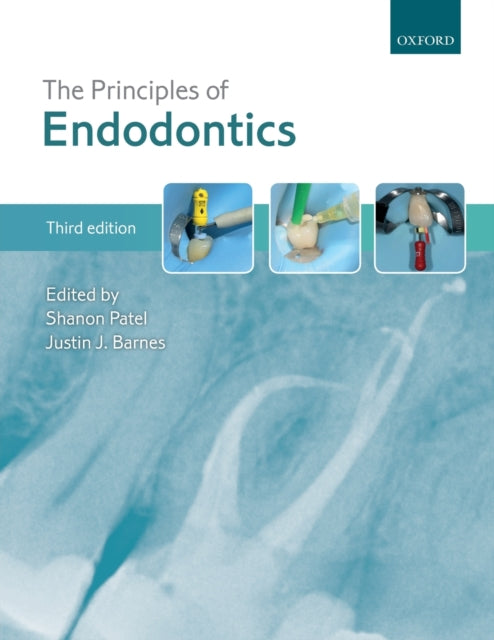 The Principles of Endodontics