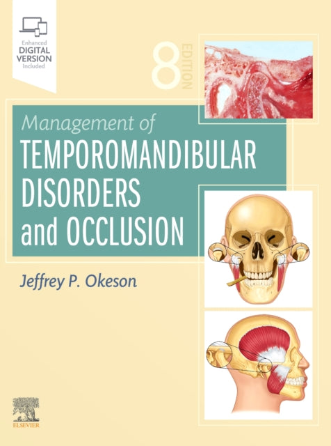 MANAGEMENT OF TEMPOROMANDIBULAR DISORDERS...