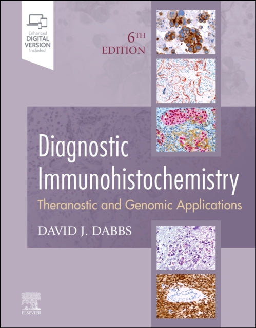 Diagnostic Immunohistochemistry - Theranostic and Genomic Applications