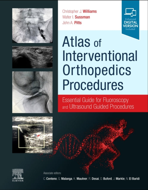 Atlas of Interventional Orthopedics Procedures - Essential Guide for Fluoroscopy and Ultrasound Guided Procedures