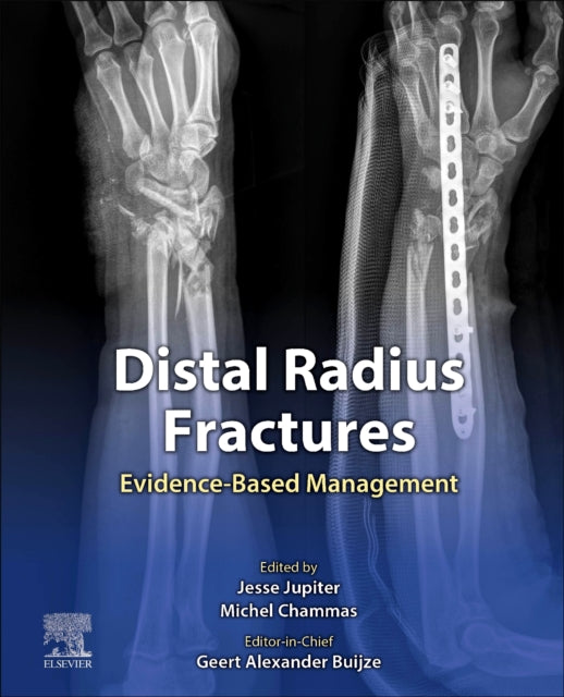 Distal Radius Fractures - Evidence-Based Management