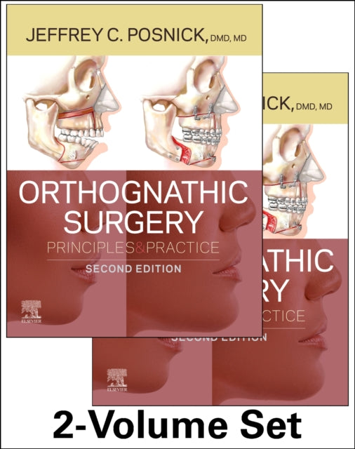 Orthognathic Surgery - 2 Volume Set