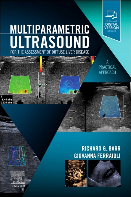 Multiparametric Ultrasound for the Assessment of Diffuse Liver Disease - A Practical Approach