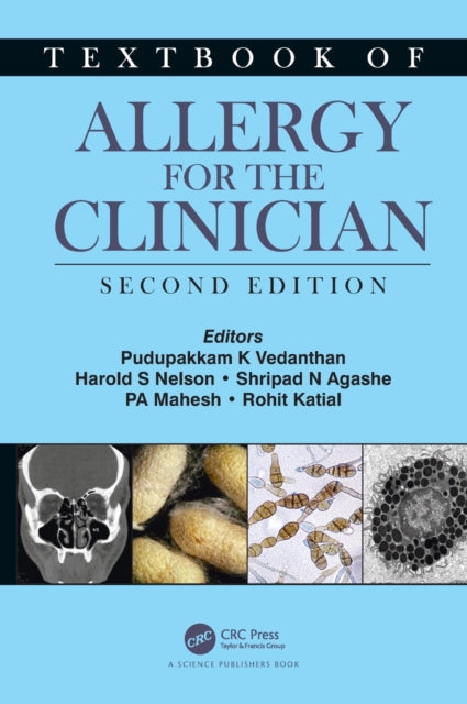 TEXTBOOK OF ALLERGY FOR THE CLINICIAN