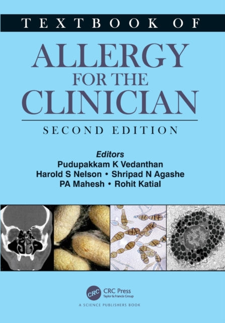 Textbook of Allergy for the Clinician