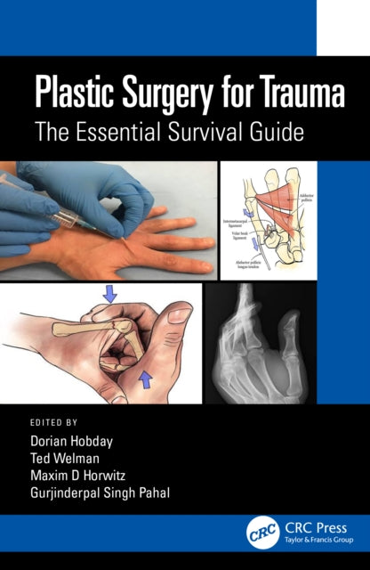 Plastic Surgery for Trauma - The Essential Survival Guide